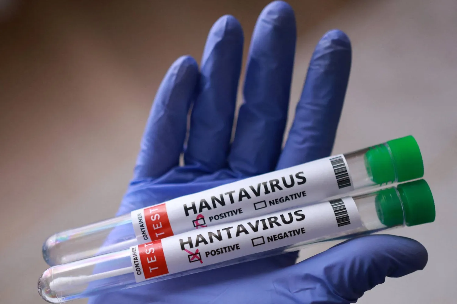 1531103jpeg - Center News Network Gloved hand holding two hantavirus test tubes, both labeled POSITIVE, with green caps on the right.