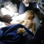 Boy lying shirtless on a hospital bed while medical staff attend to him in an emergency setting, bright light overhead.