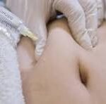 Close-up of a clinician's gloved hands on a patient's abdomen during a medical procedure; 'CNP' watermark visible.