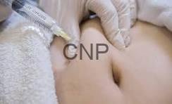 Close-up of a clinician's gloved hands on a patient's abdomen during a medical procedure; 'CNP' watermark visible.