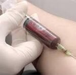 Medical professional wearing gloves drawing blood from a patient's arm with a syringe (blood draw). If context is a clinical setting, this indicates a blood sample collection.